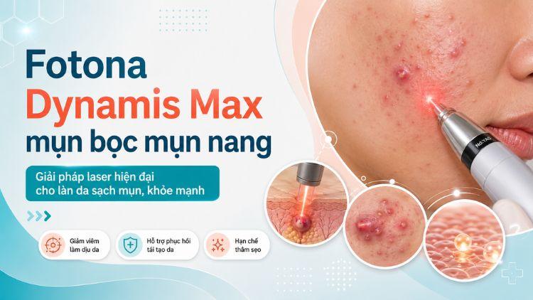 Fotona Dynamis Max mụn bọc mụn nang