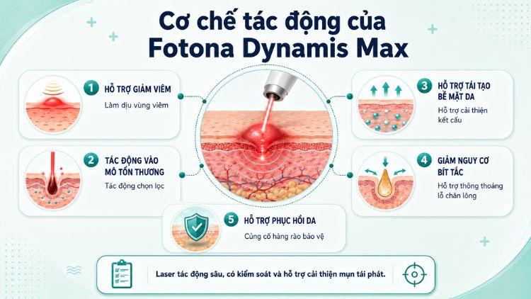 Fotona Dynamis Max tác động sâu vào nang lông
