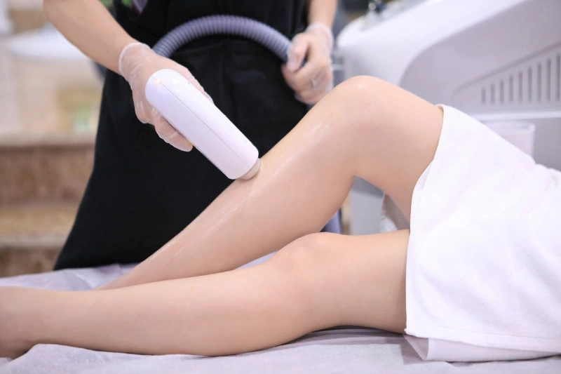 Triệt lông IPL có đau không?