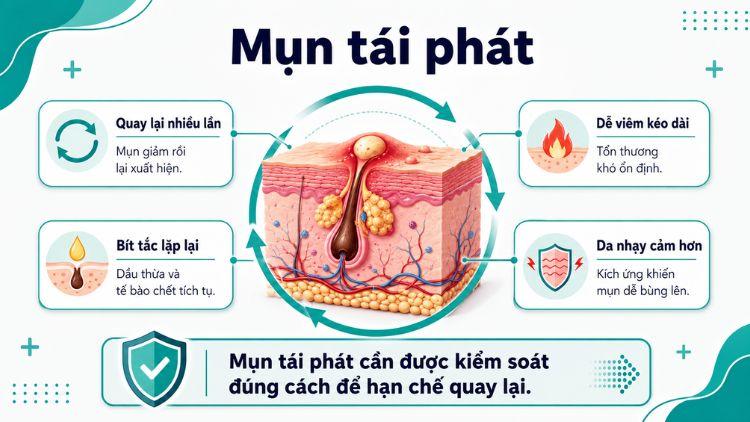 mụn tái phát