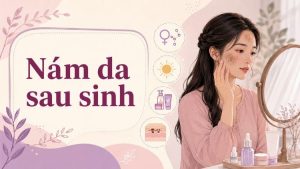 nám da sau sinh