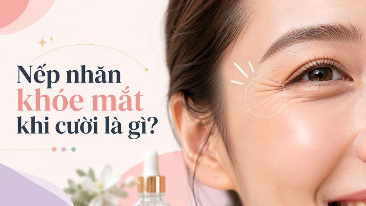 Đường nhăn đuôi mắt xuất hiện khi gương mặt cười