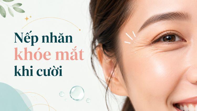 nếp nhăn khóe mắt khi cười