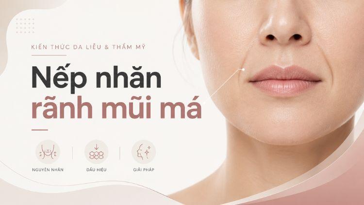 nếp nhăn tĩnh và nếp nhăn động
