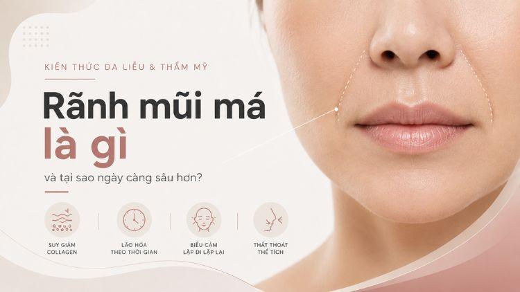 Rãnh mũi má sâu dần theo quá trình lão hóa