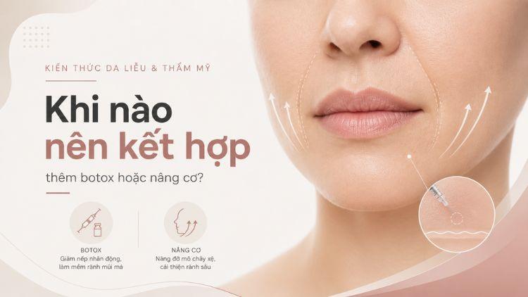Phối hợp filler với botox hoặc công nghệ nâng cơ