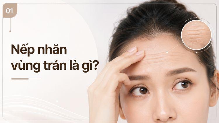 Nếp nhăn ngang ở vùng trán xuất hiện khi biểu cảm