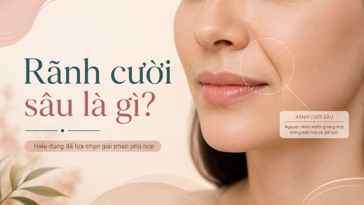 Độ sâu rãnh cười khác nhau tùy cấu trúc khuôn mặt