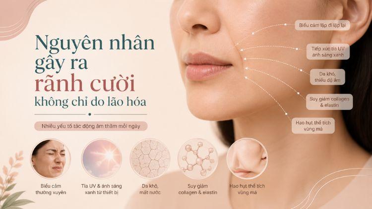 Mất collagen và mô má làm rãnh cười rõ hơn