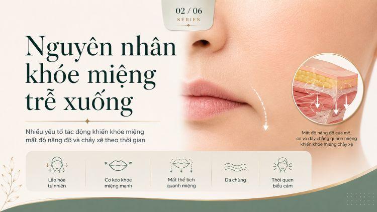Khóe miệng trễ khiến gương mặt trông buồn hơn