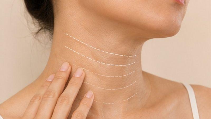 Dấu hiệu lão hóa da cổ