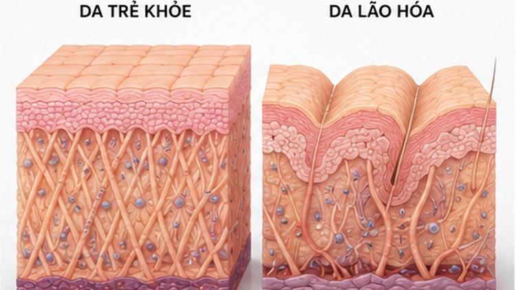 Cấu trúc da cổ lão hóa