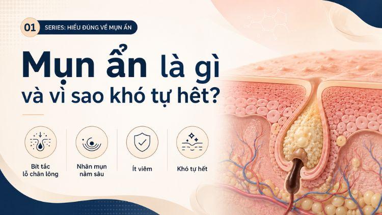 Mụn ẩn dưới da gây sần và kém mịn