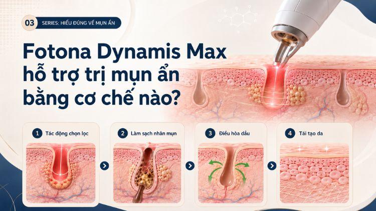 Laser tác động bề mặt và nền da dễ bít tắc