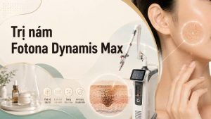 Trị nám Fotona Dynamis Max