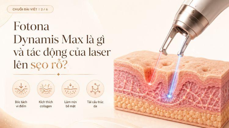 Laser Fotona Dynamis hỗ trợ cải thiện kết cấu da