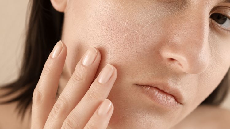 BAP Profhilo phù hợp khi da thiếu ẩm, giảm đàn hồi và lão hóa nhẹ