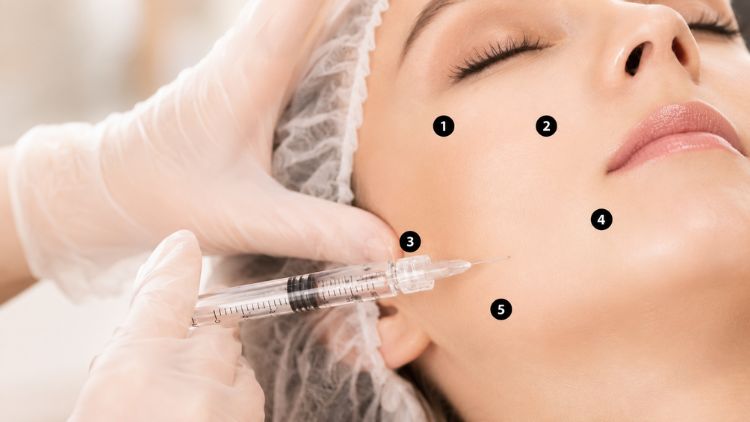 Quy trình BAP Profhilo gồm thăm khám, tiêm và theo dõi sau tiêm