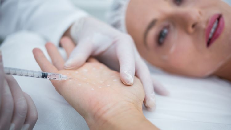 Botox giảm tiết mồ hôi là gì?