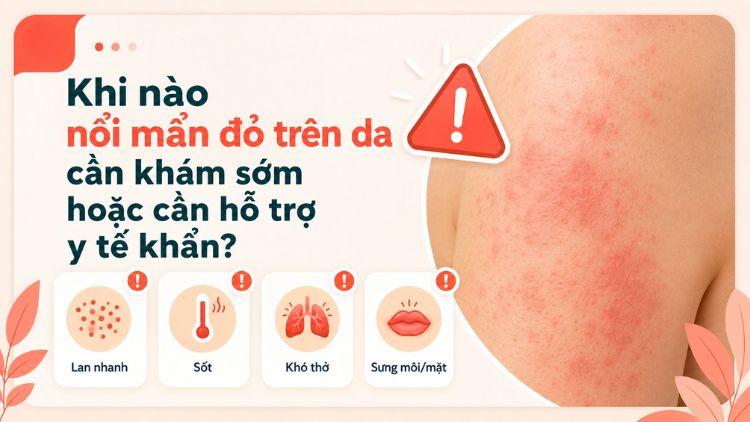 Dấu hiệu mẩn đỏ cần khám sớm hoặc cấp cứu