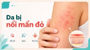 da bị nổi mẩn đỏ