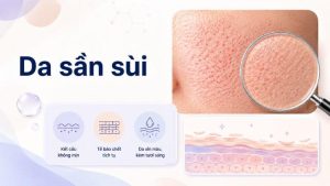 da sần sùi