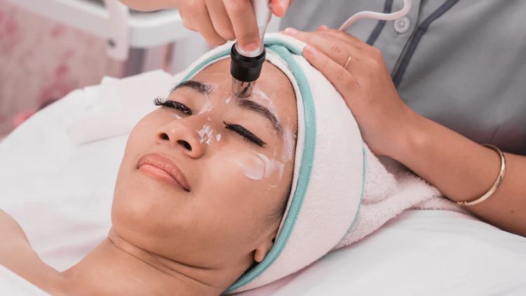RF TriPollar thon gọn hàm tại Citrine Derma Clinic