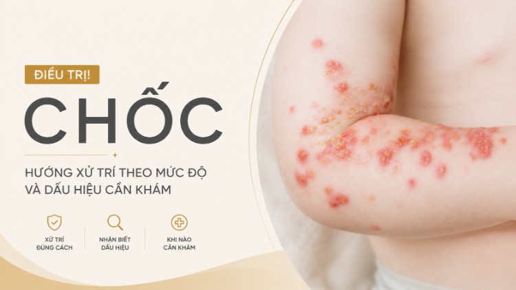 Điều Trị Chốc: Cách Chăm Sóc Và Ngăn Lây | Citrine