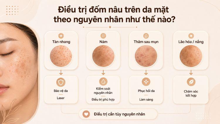 Điều trị sắc tố được lựa chọn theo nguyên nhân