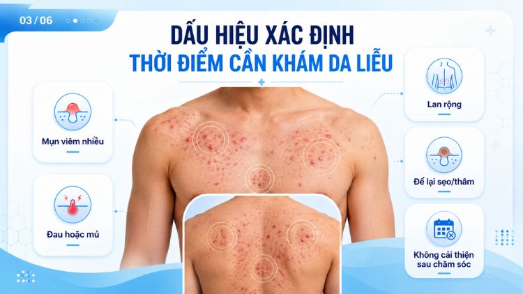 Dấu hiệu xác định thời điểm cần khám da liễu