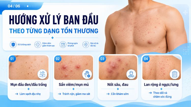 Hướng xử lý ban đầu theo từng dạng tổn thương