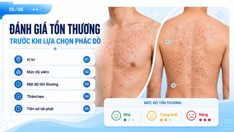 Đánh giá tổn thương trước khi lựa chọn phác đồ