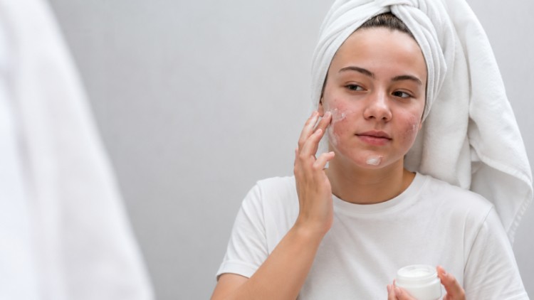Làm sạch và dưỡng ẩm dịu nhẹ giúp hạn chế kích ứng ở da rosacea