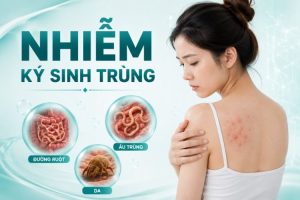 Nhiễm Ký Sinh Trùng: Triệu Chứng, Đường Lây Và Phòng Tránh