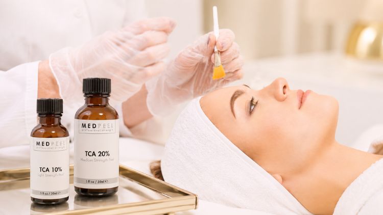 TCA thường dùng cho peel trung bình với nồng độ 10-35%