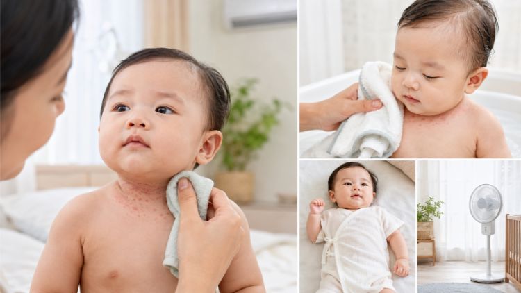 Chăm sóc rôm sảy cho trẻ tại nhà