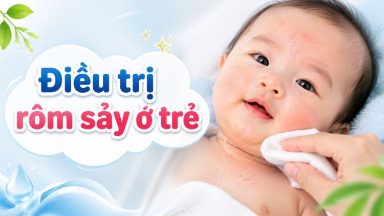 Điều Trị Rôm Sảy Ở Trẻ: Chăm Sóc, Phòng Bội Nhiễm | Citrine