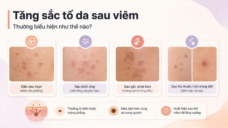 Nhận diện màu sắc và vị trí vết sạm