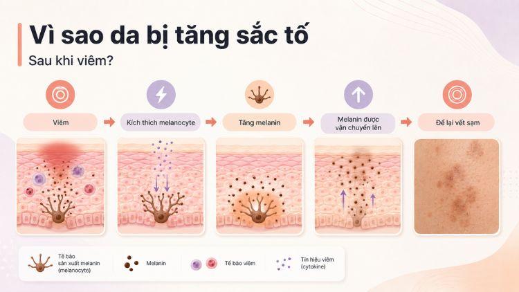 Các tác nhân viêm khiến da lưu giữ sắc tố