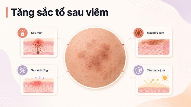 tăng sắc tố sau viêm