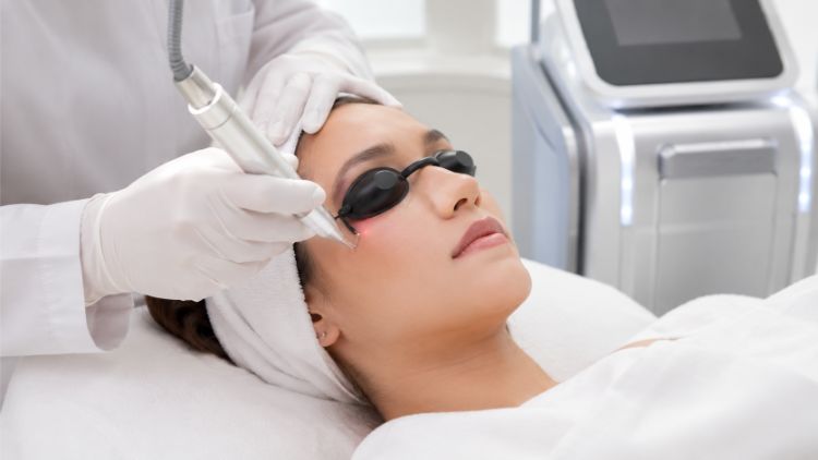 Giới hạn của laser trị quầng thâm mắt