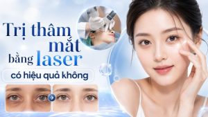 Trị Thâm Mắt Bằng Laser Có Hiệu Quả Không? Kết Quả Thực Tế