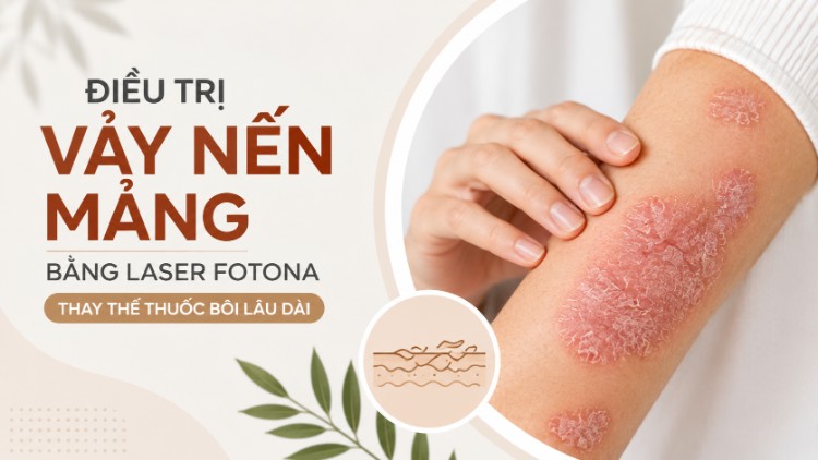 Điều Trị Vảy Nến Mảng Bằng Laser Fotona Thế Nào? | Citrine