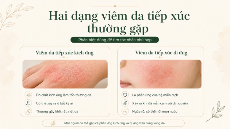 So sánh viêm da tiếp xúc kích ứng ở tay và dị ứng trên má