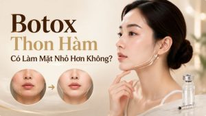 Botox Thon Hàm Có Làm Mặt Nhỏ Hơn Không? | Citrine