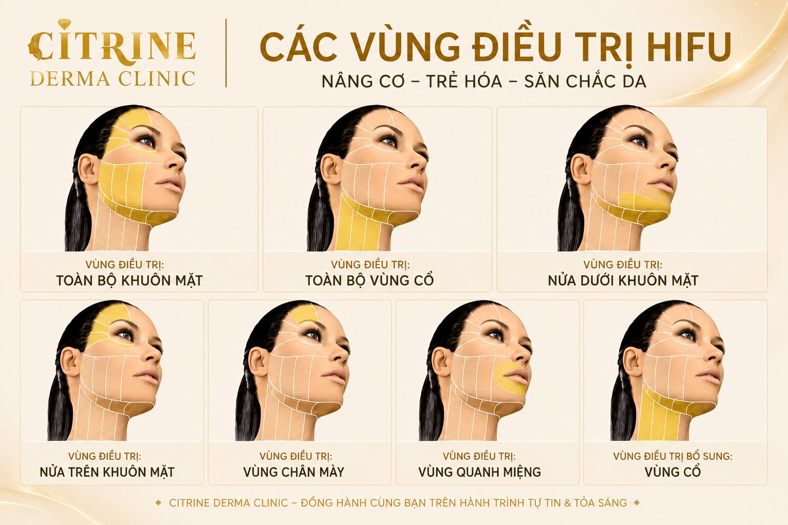 dịch vụ nâng cơ hifu