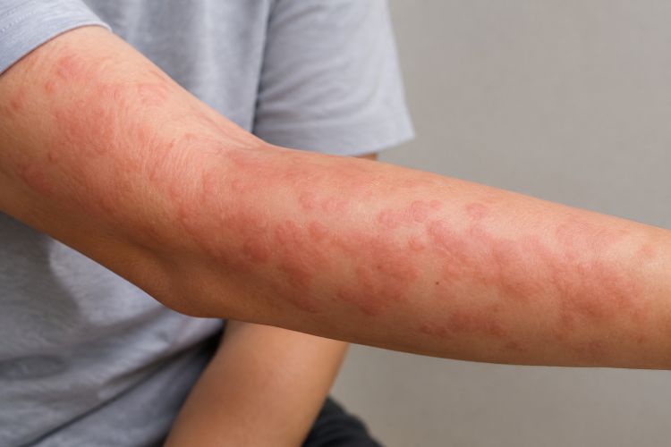 Nhận biết dấu hiệu bất thường để được thăm khám và xử trí kịp thời