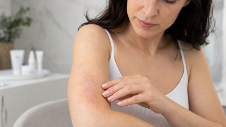 Da chỉ nên được đánh giá trẻ hóa khi vảy nến đã ổn định