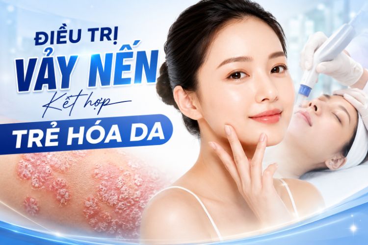 Điều Trị Vảy Nến Kết Hợp Trẻ Hóa Da An Toàn | Citrine