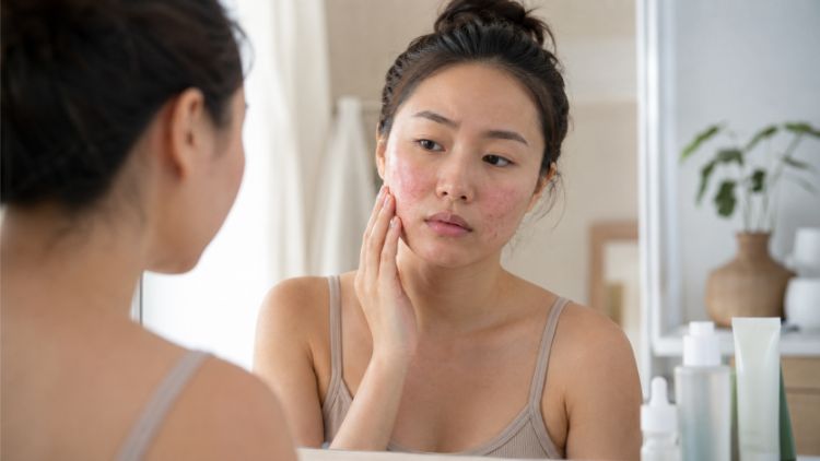 Sưng đỏ tăng kèm đau nóng hoặc rỉ dịch cần được bác sĩ kiểm tra